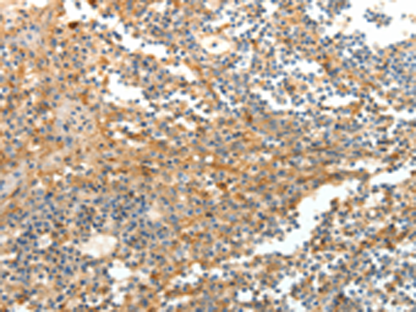 Anti-DTX3 Rabbit Polyclonal Antibody