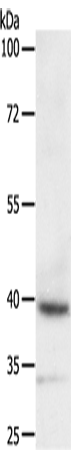 Anti-DTX3 Rabbit Polyclonal Antibody