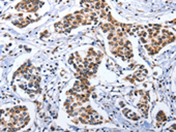 Anti-DOK3 Rabbit Polyclonal Antibody