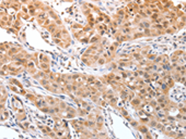 Anti-DPPA2 Rabbit Polyclonal Antibody