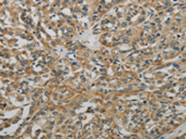 Anti-E2F6 Rabbit Polyclonal Antibody