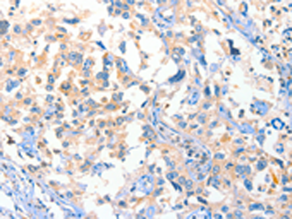 Anti-DUSP14 Rabbit Polyclonal Antibody