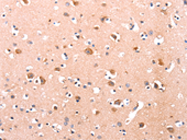 Anti-DUSP12 Rabbit Polyclonal Antibody
