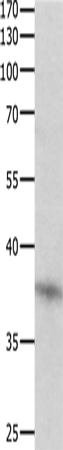 Anti-DUSP12 Rabbit Polyclonal Antibody