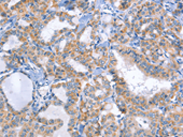 Anti-DUSP10 Rabbit Polyclonal Antibody
