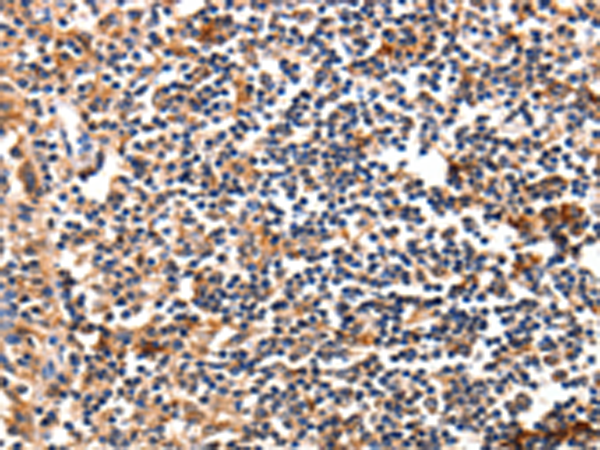 Anti-FADD Rabbit Polyclonal Antibody