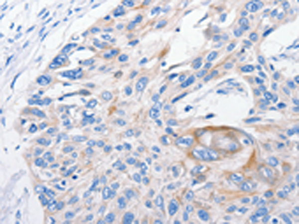 Anti-FANCF Rabbit Polyclonal Antibody