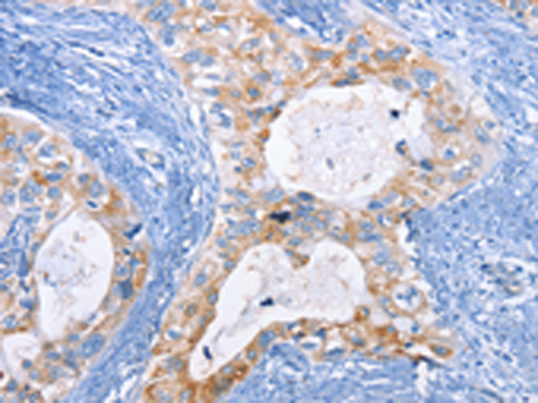 Anti-FLIP Rabbit Polyclonal Antibody