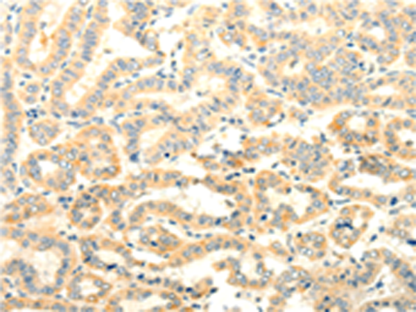 Anti-FOXR2 Rabbit Polyclonal Antibody