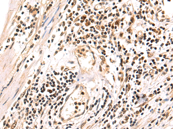 Anti-T Box Protein 22 Rabbit Polyclonal Antibody