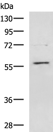 Anti-T Box Protein 22 Rabbit Polyclonal Antibody