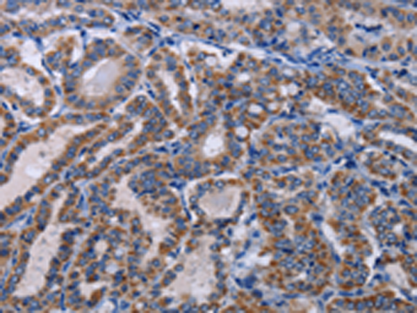 Anti-GNAS Rabbit Polyclonal Antibody