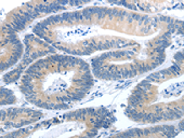 Anti-GNAZ Rabbit Polyclonal Antibody