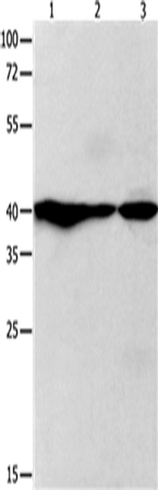Anti-GNAZ Rabbit Polyclonal Antibody