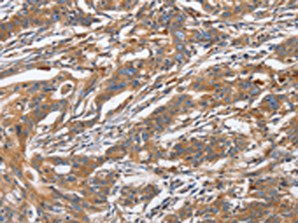 Anti-GNA13 Rabbit Polyclonal Antibody