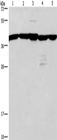 Anti-GNA13 Rabbit Polyclonal Antibody