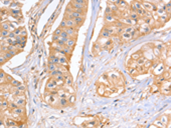 Anti-GNB1 Rabbit Polyclonal Antibody