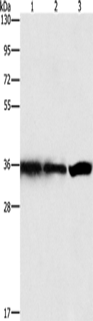 Anti-GNB1 Rabbit Polyclonal Antibody