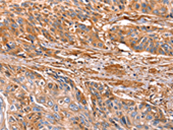 Anti-Galectin 1 Rabbit Polyclonal Antibody