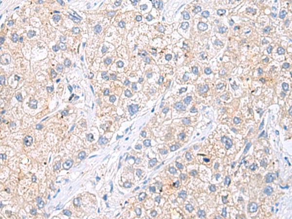 Anti-LGALS2 Rabbit Polyclonal Antibody