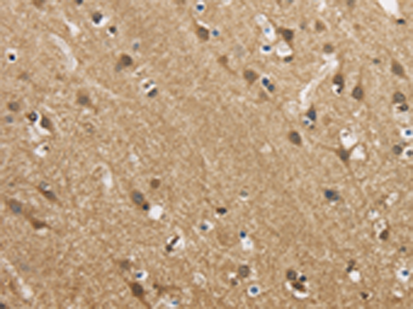 Anti-GAS7 Rabbit Polyclonal Antibody