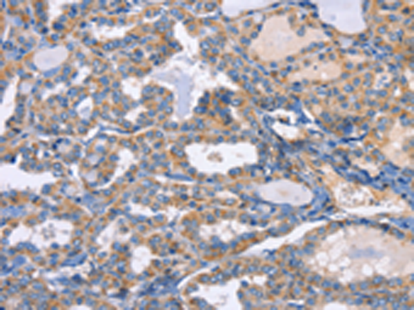 Anti-GRO gamma Rabbit Polyclonal Antibody