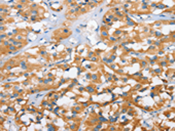 Anti-CXCL14 Rabbit Polyclonal Antibody