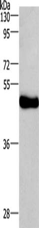 Anti-Ceramide glucosyltransferase Rabbit Polyclonal Antibody
