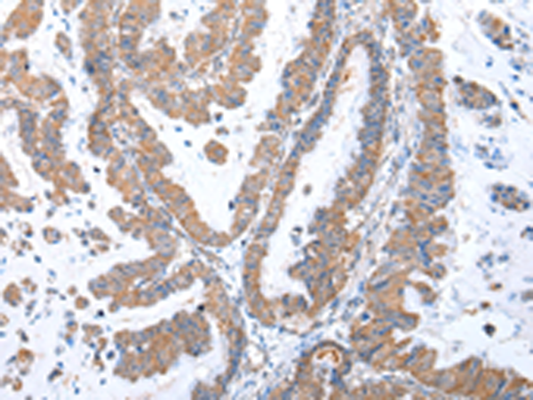 Anti-GRB14 Rabbit Polyclonal Antibody