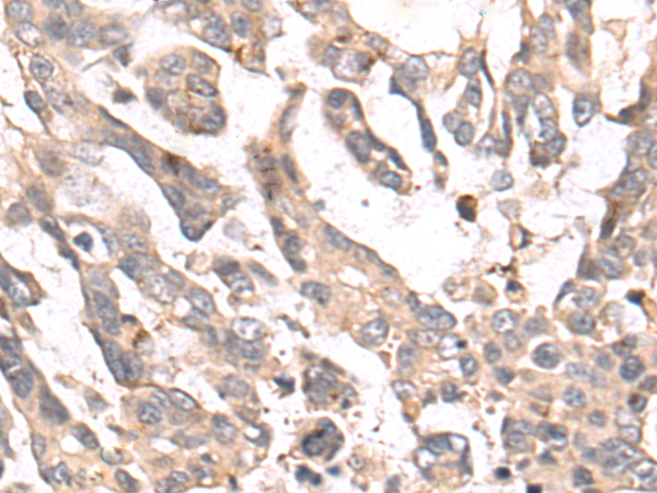 Anti-GRK4 Rabbit Polyclonal Antibody