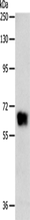 Anti-GRK4 Rabbit Polyclonal Antibody