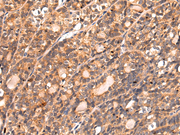 Anti-OGA Rabbit Polyclonal Antibody