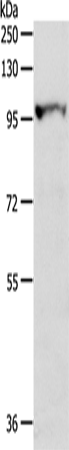 Anti-OGA Rabbit Polyclonal Antibody