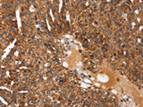 Anti-ERG2 Rabbit Polyclonal Antibody