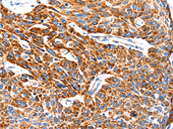 Anti-Hsp75 Rabbit Polyclonal Antibody