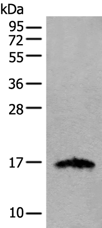 Anti-IGF2 Rabbit Polyclonal Antibody