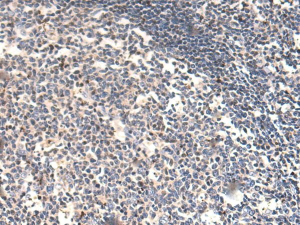 Anti-IL-15 Rabbit Polyclonal Antibody