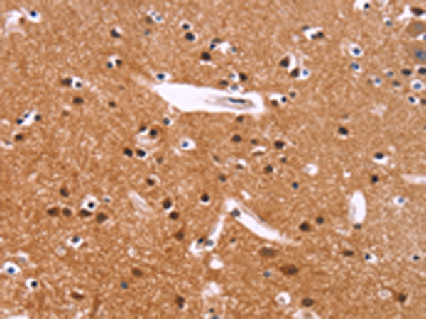 Anti-SIMPL Rabbit Polyclonal Antibody