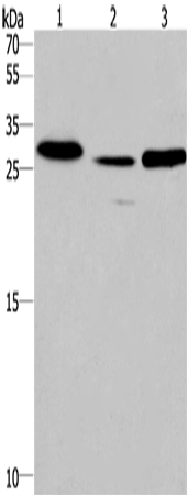 Anti-SIMPL Rabbit Polyclonal Antibody
