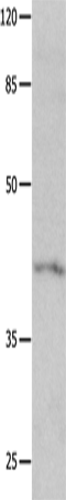 Anti-KCNA5 Rabbit Polyclonal Antibody