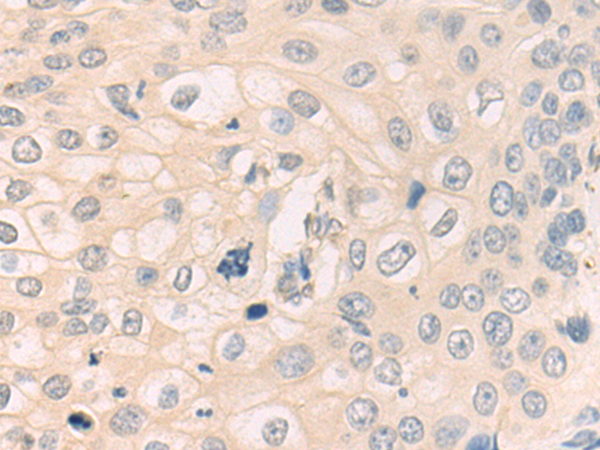 Anti-Kallikrein 4 Rabbit Polyclonal Antibody