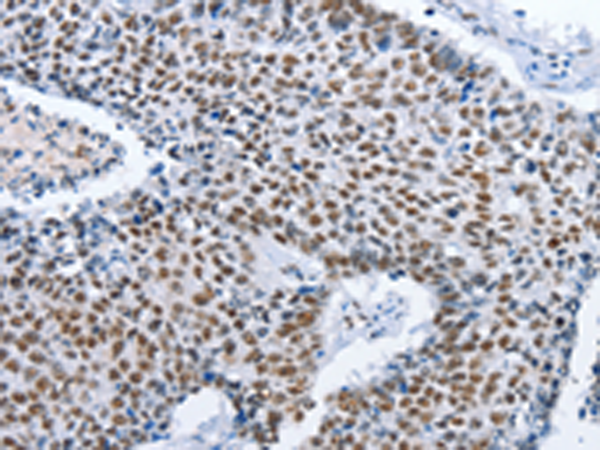 Anti-GNRH1 Rabbit Polyclonal Antibody