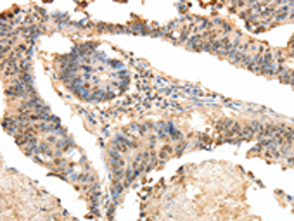 Anti-LRP12 Rabbit Polyclonal Antibody