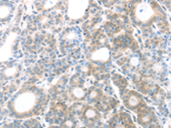 Anti-MAGED1 Rabbit Polyclonal Antibody