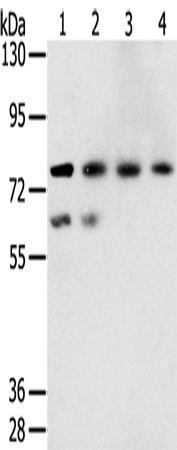 Anti-Transmembrane Protease Serine 7 Rabbit Polyclonal Antibody