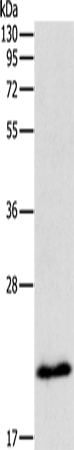 Anti-MGMT Rabbit Polyclonal Antibody