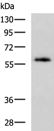 Anti-MYLK2 Rabbit Polyclonal Antibody