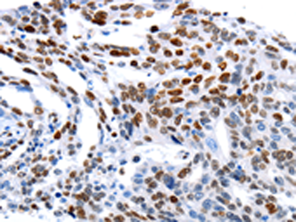 Anti-MUTYH Rabbit Polyclonal Antibody