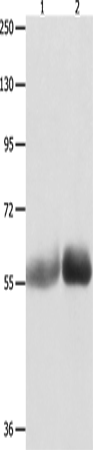 Anti-MUTYH Rabbit Polyclonal Antibody
