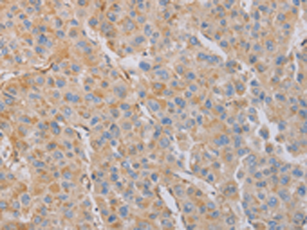 Anti-MYL6 Rabbit Polyclonal Antibody